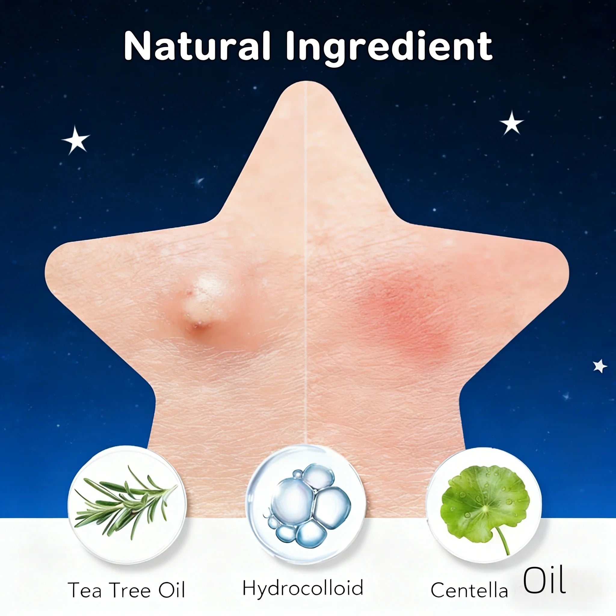 252/504/1008-Piece HITWORKER Acne Patches | Housse invisible contre les imperfections, enrichie d’huile d’arbre à thé, nettoyage doux