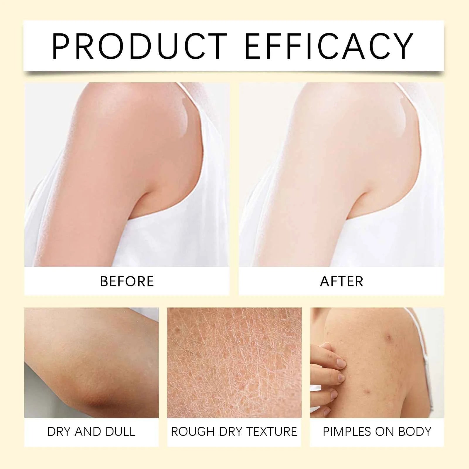 Bee Venom Skin Moisturizer, Gentle Hydrating, Smooth & Delicate, Nourishes Skin, Ideal For Daily Body Care Routine