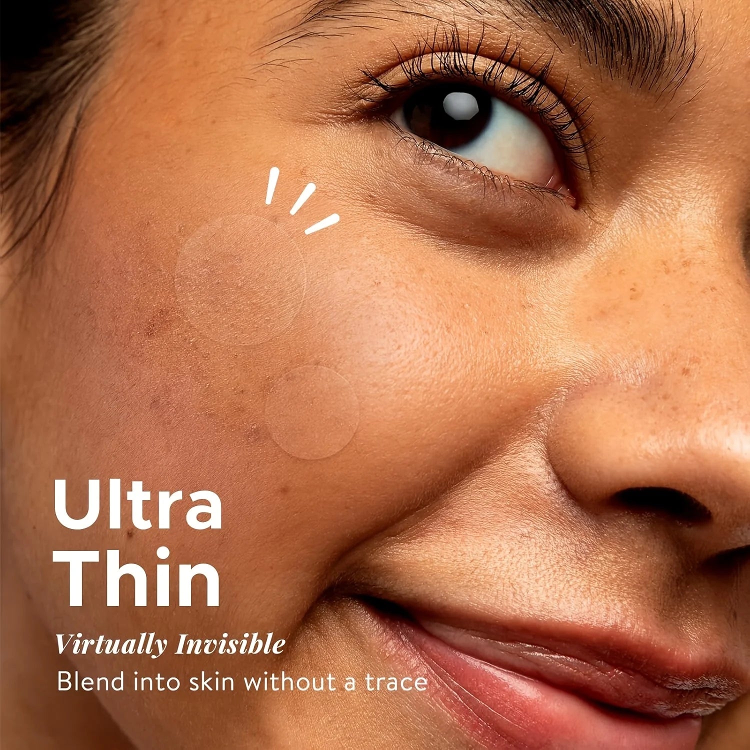 360Count Acne Patch, Covers Pimple And Acne, Acne Pimple Patch for Covering Zits And Blemishes, Spot Stickers for Face And Skin