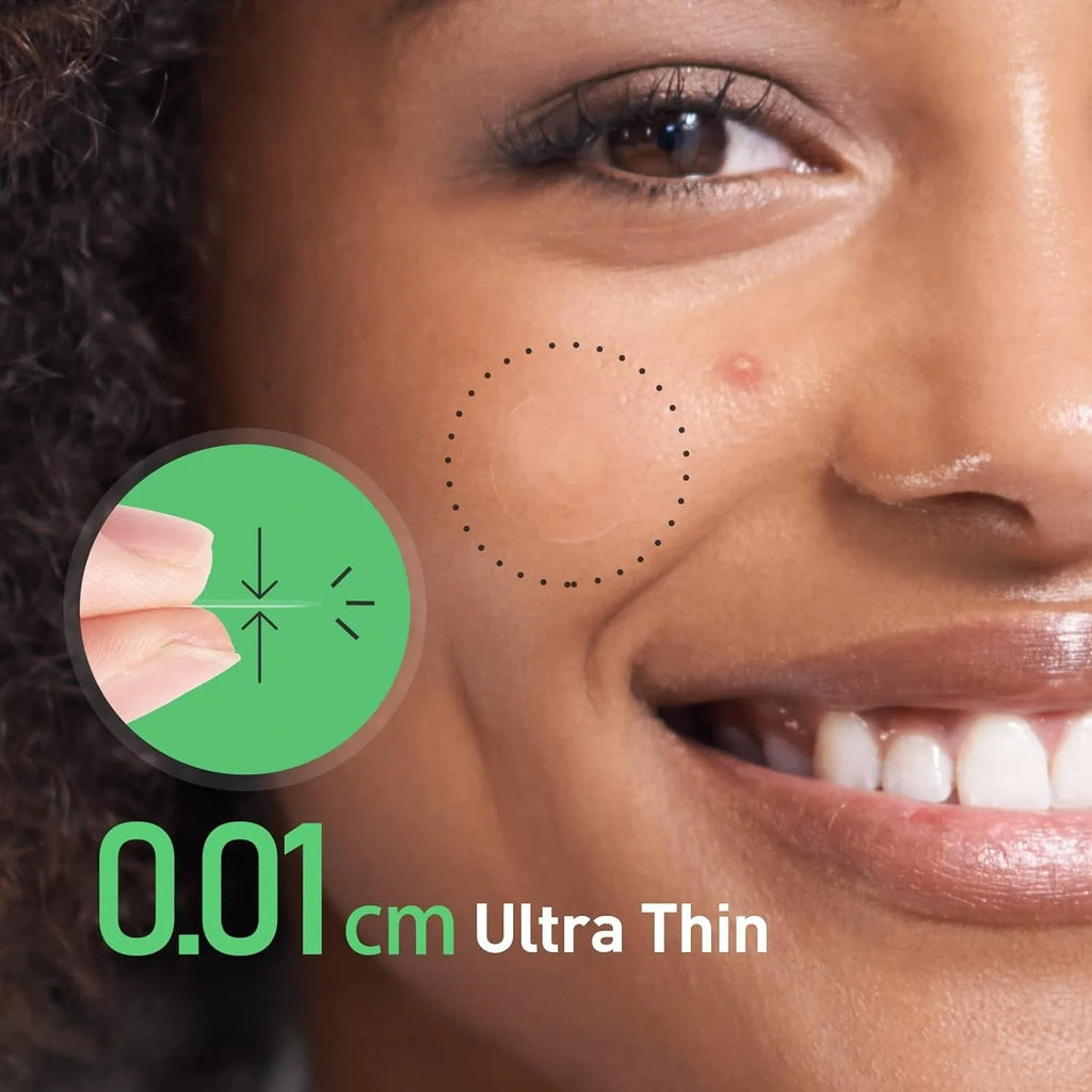 27/54/81-Piece HITWORKER Acne Patches - Infused with Salicylic Acid, Tea Tree Oil & Calendula Oil | For Acne & Blemishes, Residu